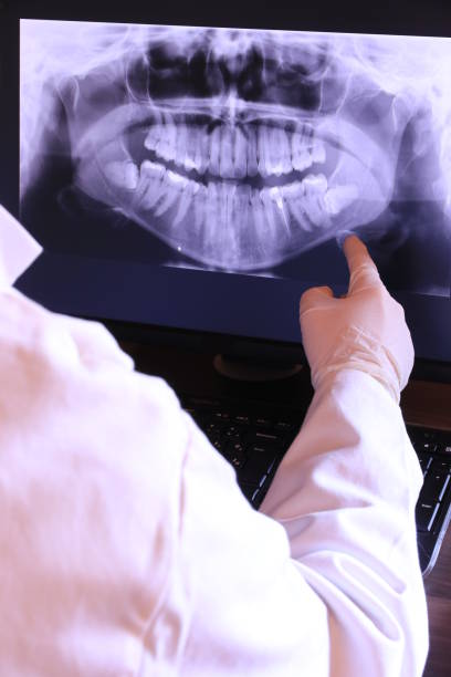 Best Emergency Treatment for Dental Infections or Abscesses in Citrus Heights, CA